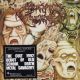 ACCIDENTAL SUICIDE - DECEASED (1 CD)